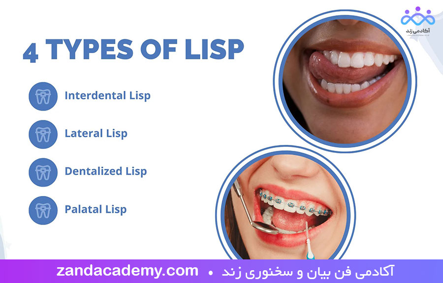 اختلل تلفظ حرف س ، ز که یکی از مهمترین اشکلات در تلفظ صحیح حروف است